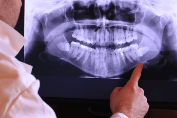 Best After-Hours Emergency Dentist in Cutler, CA
