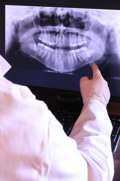 Best Emergency Dental Surgery in Cutler, CA