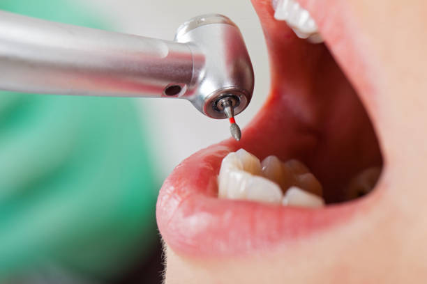 Best Walk-In Emergency Dentist in Cutler, CA